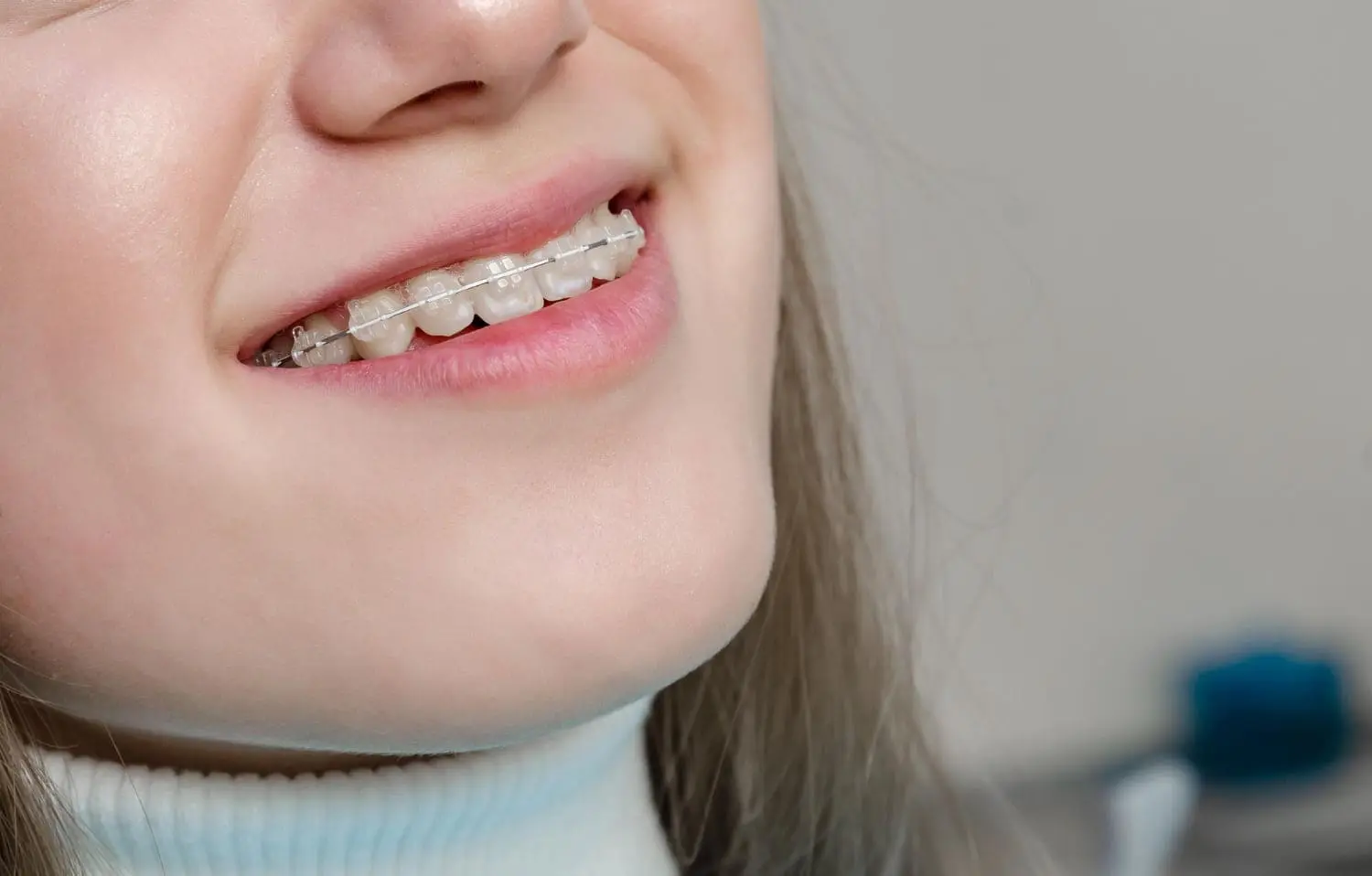 Close-up of a person smiling, showing teeth with ceramic braces. Adult Brace from Chauncey Orthodontics add to their confident look as they in Henderson, NV.