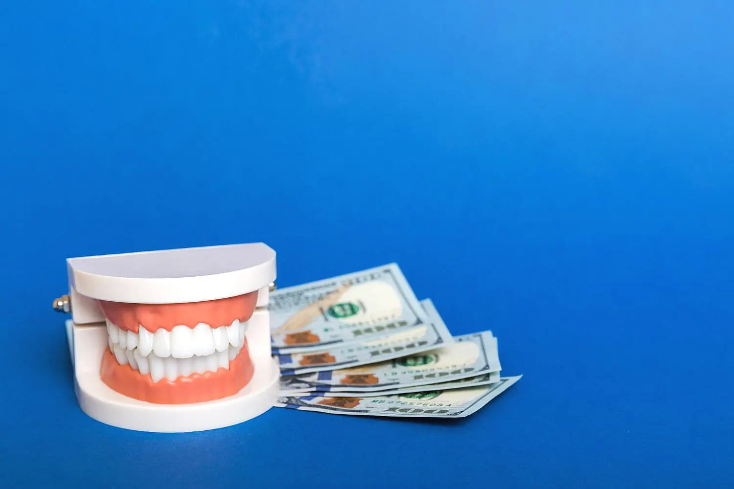 A dental model and several hundred-dollar bills are artfully arranged on a blue background, highlighting the value of investing in clear braces for a transformed smile in Henderson, NV