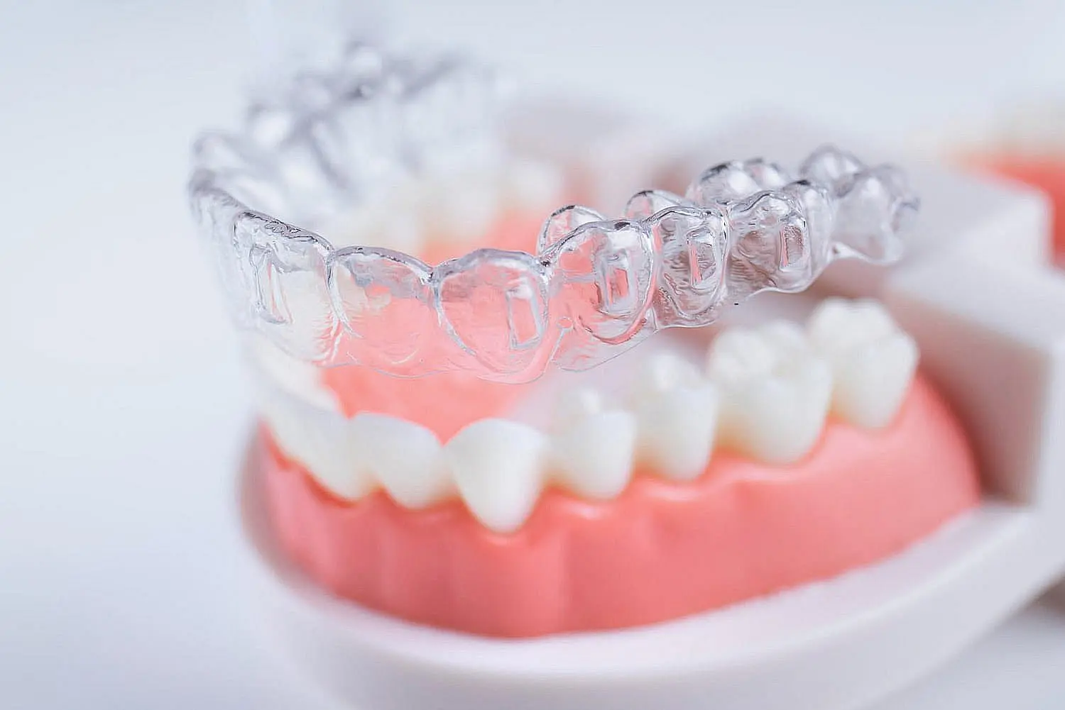 A clear dental aligner is elegantly positioned above a set of artificial teeth on a dental model, illustrating the effectiveness and appeal of Invisalign. With flexible payment plans available, achieving that perfect smile has never been more accessible in Henderson, NV.