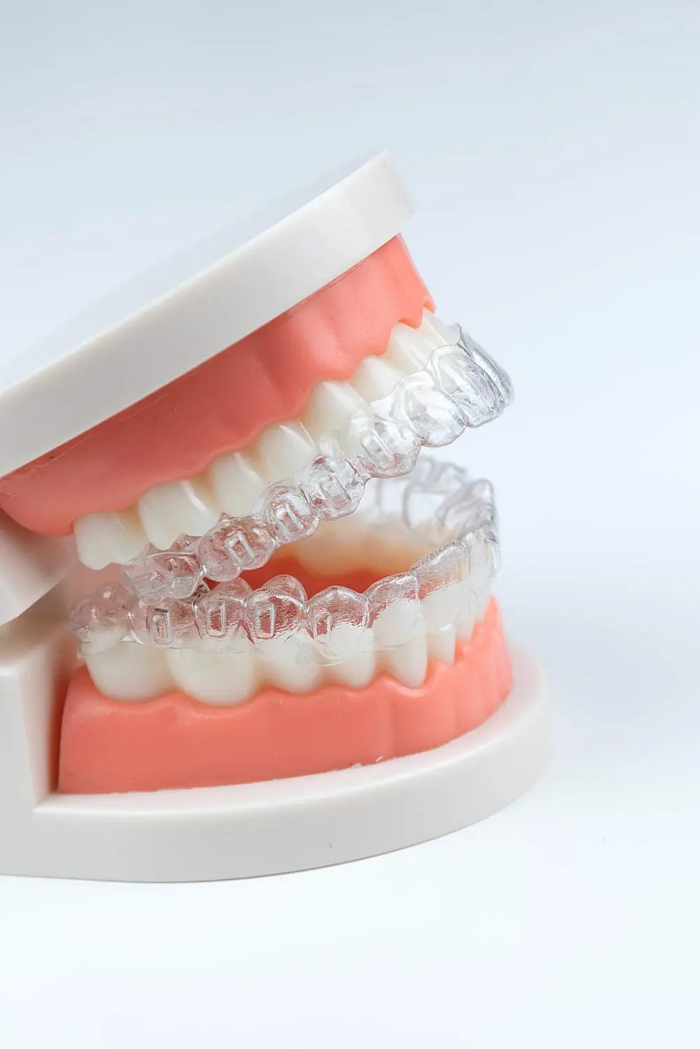 A dental model with artificial teeth displays a clear aligner fitted on the top row, highlighting how Invisalign Payment Plan options can make achieving a straighter smile more accessible in Henderson, NV.