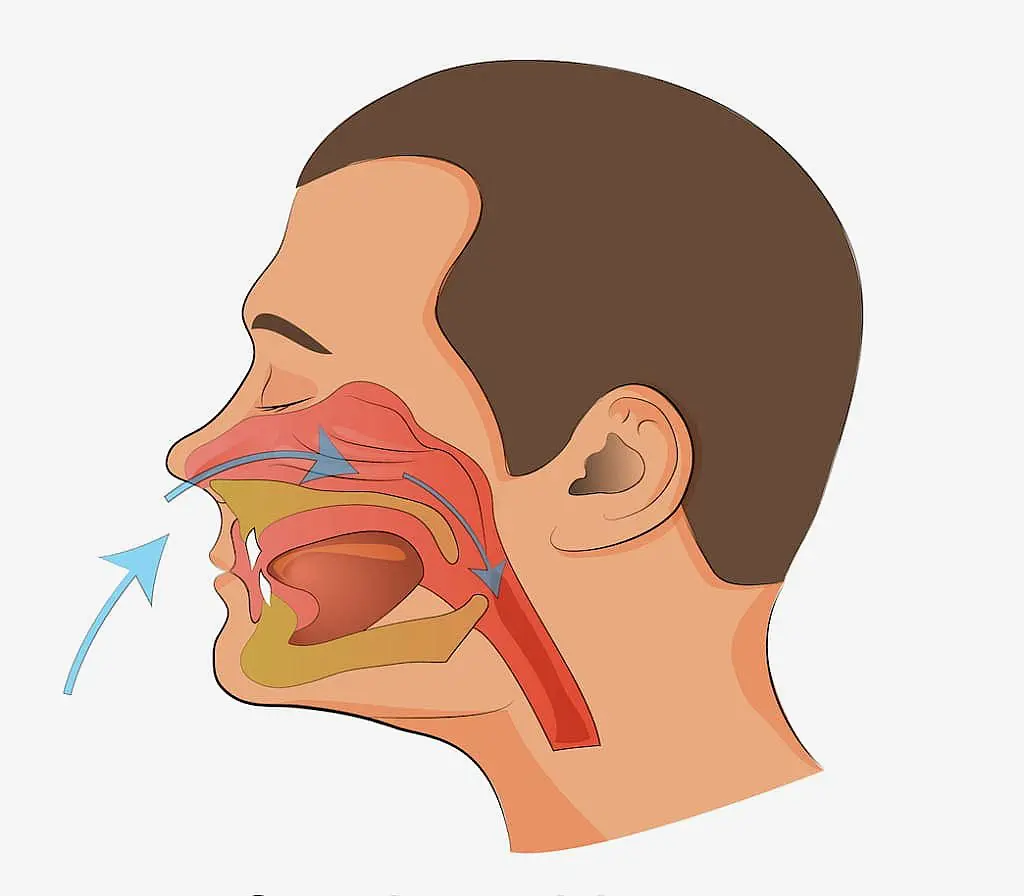 A diagram of a human head profile illustrates the nasal cavity, mouth and throat passages with arrows showing airflow direction, highlighting a mouth breather’s airflow route. Available at Chauncey Orthodontics in Henderson, NV.