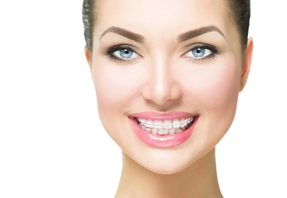Chauncey Orthodontics A person grins, showcasing clear braces that align their teeth perfectly, with bright blue eyes and neatly groomed eyebrows against a plain white background in Henderson, NV