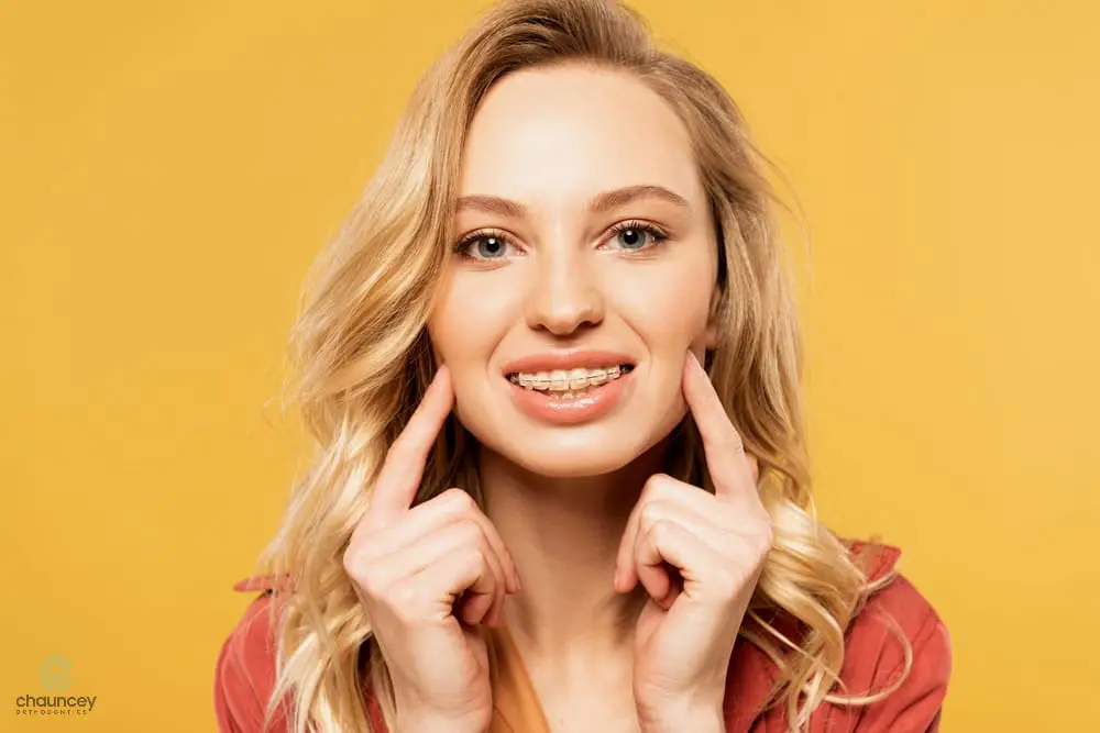 A young woman with blonde hair smiles and points to her braces with both index fingers against a yellow background - Overbite vs Underbite in Henderson, NV.