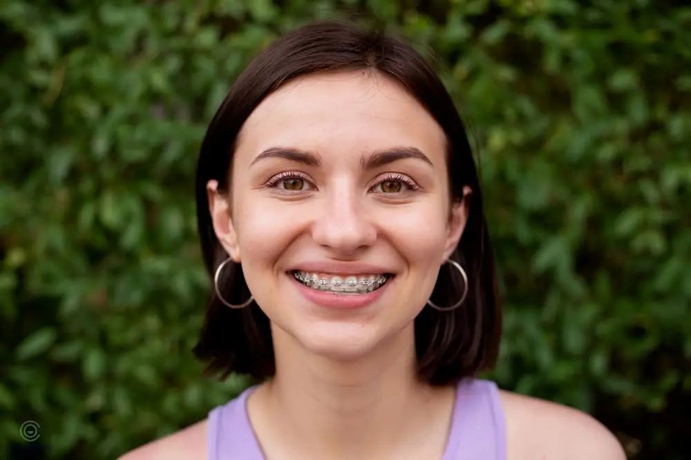 A young woman with straight brown hair and braces smiles at the camera, standing in front of leafy green foliage - Aligners vs Braces in Henderson, NV