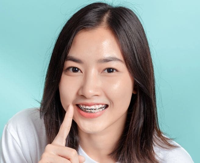 Young woman with straight dark hair smiles, showing metal braces on her teeth, and points to her mouth in Henderson, NV.